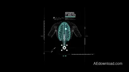 HUD Abdominal Analysis Infographics template preview